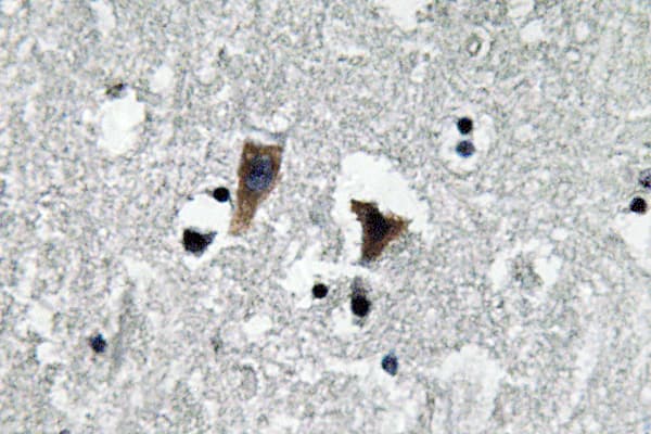 Polyclonal Rabbit anti-Human MAOA / Monoamine Oxidase Antibody (Pro347, IHC, WB)
