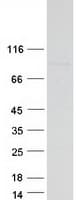 Human FBXO40 Protein (Recombinant Myc-DDK (Flag))