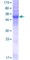 Human OPPO1 / ODF4 Protein (Recombinant GST)