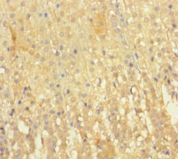 EML2 / EMAP2 Antibody (aa1-418)