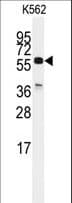 Polyclonal Rabbit anti-Human CDC25C Antibody (aa376-402, WB)