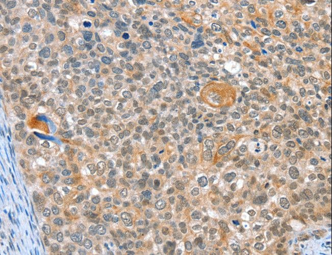Polyclonal Rabbit anti-Human ALDOB Antibody (IHC, WB)