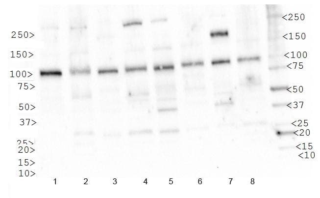 IGF1R / IGF1 Receptor Antibody