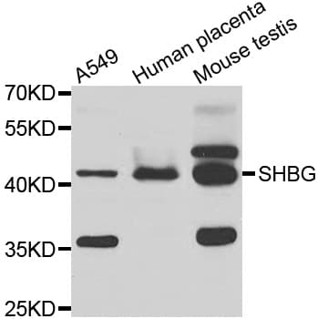 SHBG Antibody
