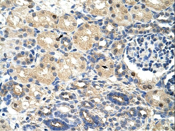Polyclonal Rabbit anti-Human SRP14 Antibody (aa38-87, IHC, WB)