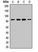 Polyclonal Rabbit anti-Human MUT / MCM Antibody (WB)