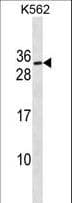 SSX3 Antibody (aa53-80)