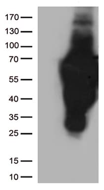 CD2 Antibody (clone UMAB86)