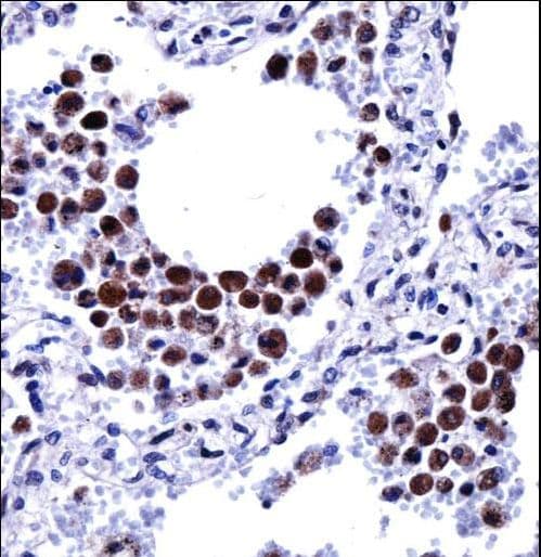 Polyclonal Rabbit anti-Human ARIH2 Antibody (aa445-474, IHC, WB)