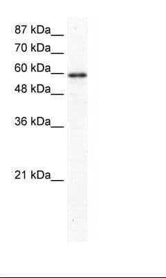 G3BP1 / G3BP Antibody (aa136-185)