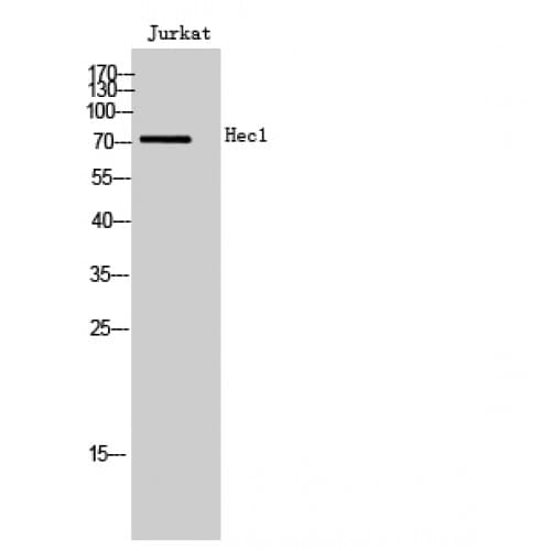 HEC1 / NDC80 Antibody (320-400 aa, Internal)