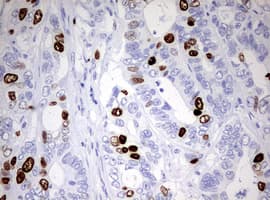 TOP2A / Topoisomerase II Alpha Antibody (aa1100-1531, clone OTI1D5)