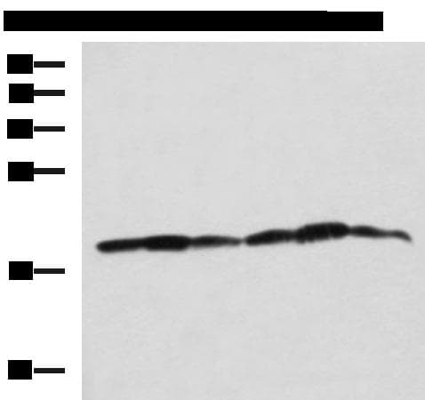 Polyclonal Rabbit anti-Human PLDN / Pallidin Antibody (IHC, WB)
