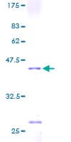 Human RPS14 / Ribosomal Protein S14 (Recombinant GST)
