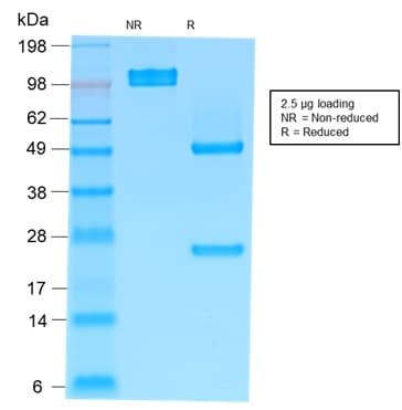 IGHM / IgM Antibody (clone rIM373)