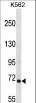 Polyclonal Rabbit anti-Human ARHGEF6 Antibody (aa614-641, WB)