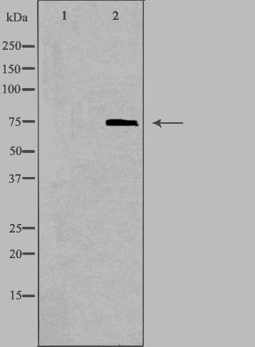 ALDP / ABCD1 Antibody