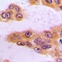 BCKDK Antibody (N-Terminus)