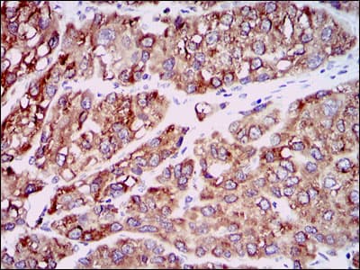CCL2 / MCP1 Antibody (clone 2D8)
