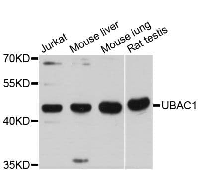 UBAC1 / KPC2 Antibody