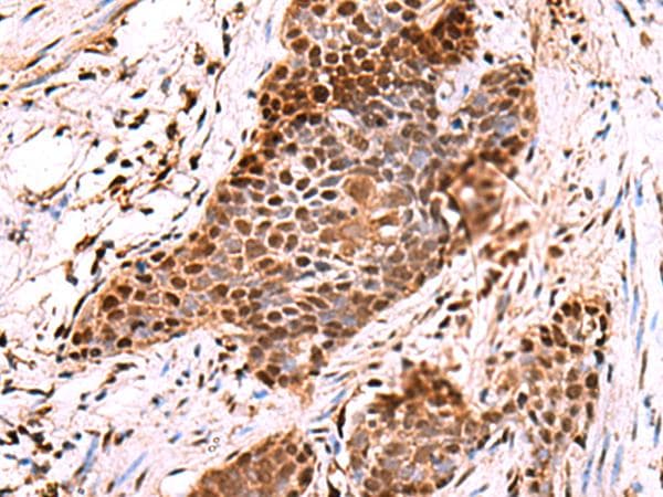 POLD2 Antibody