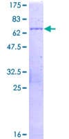 Human SMCHD1 Protein (Recombinant GST)