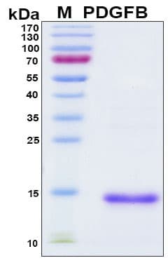Mouse PDGF-BB Protein (Recombinant 6His, N-terminus)