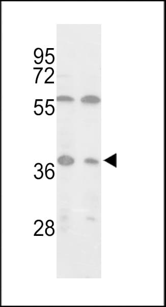 IDH3A Antibody (aa317-346)