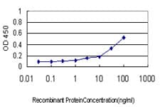 ASNS Antibody (clone 3B3)
