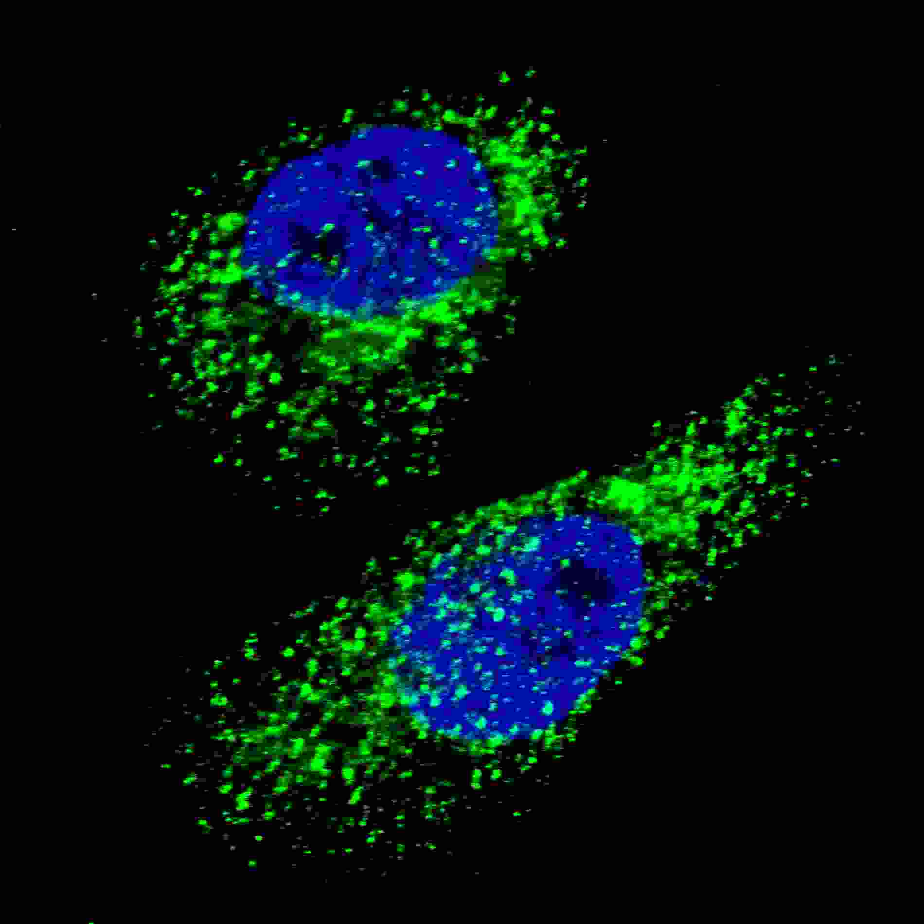 Polyclonal Rabbit anti-Human MAP1LC3A / LC3A Antibody (aa91-117, IF, WB)
