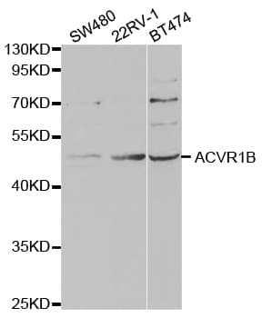 ACVR1B / ALK4 Antibody