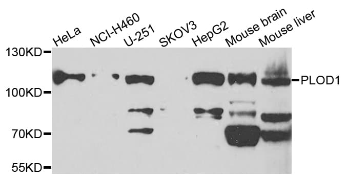 PLOD / PLOD1 Antibody