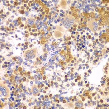Polyclonal Rabbit anti-Human DTX2 Antibody (IHC, WB)