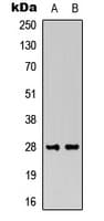 FGF13 Antibody (Internal)
