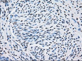 SORD / Sorbitol Dehydrogenase Antibody (clone OTI12A7)