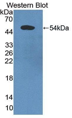 PDCD6IP / ALIX Antibody (aa174-383, Cy3)