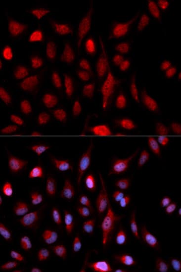 Polyclonal Rabbit anti-Human ASH2L / ASH2 Antibody (IHC, IF, WB)