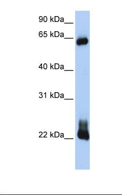 RHOD Antibody (C-Terminus)