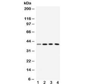 VASP Antibody