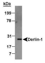 DERL1 / Derlin 1 Antibody (C-Terminus, DY650)