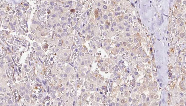EXOC3 / SEC6 Antibody