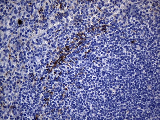 KRT84 / Keratin 84 / KRTHB4 Antibody (clone OTI2D1, Carrier-free)