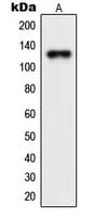 Polyclonal Rabbit anti-Human SDCCAG1 / NEMF Antibody (C-Terminus, IHC, WB)