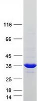 Human SULT1A4 / Sulfotransferase 1A4 Protein (Recombinant Myc-DDK (Flag))