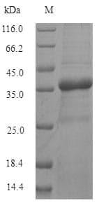Human TMEM65 Protein (Recombinant 6His-SUMO, N-terminus)