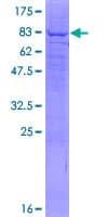 Human PIP5K1A Protein (Recombinant GST)