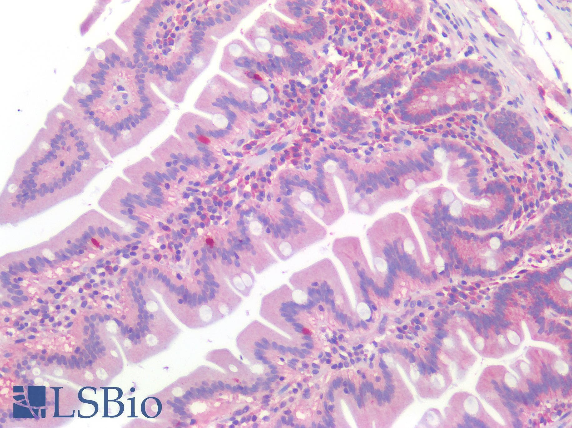 IHC-plus™ ALK2 / ACVR1 Antibody