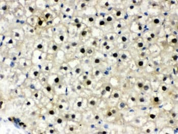 Polyclonal Rabbit anti-Human DDB1 Antibody (IHC, WB)