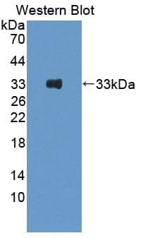 LAT Antibody (aa33-227)