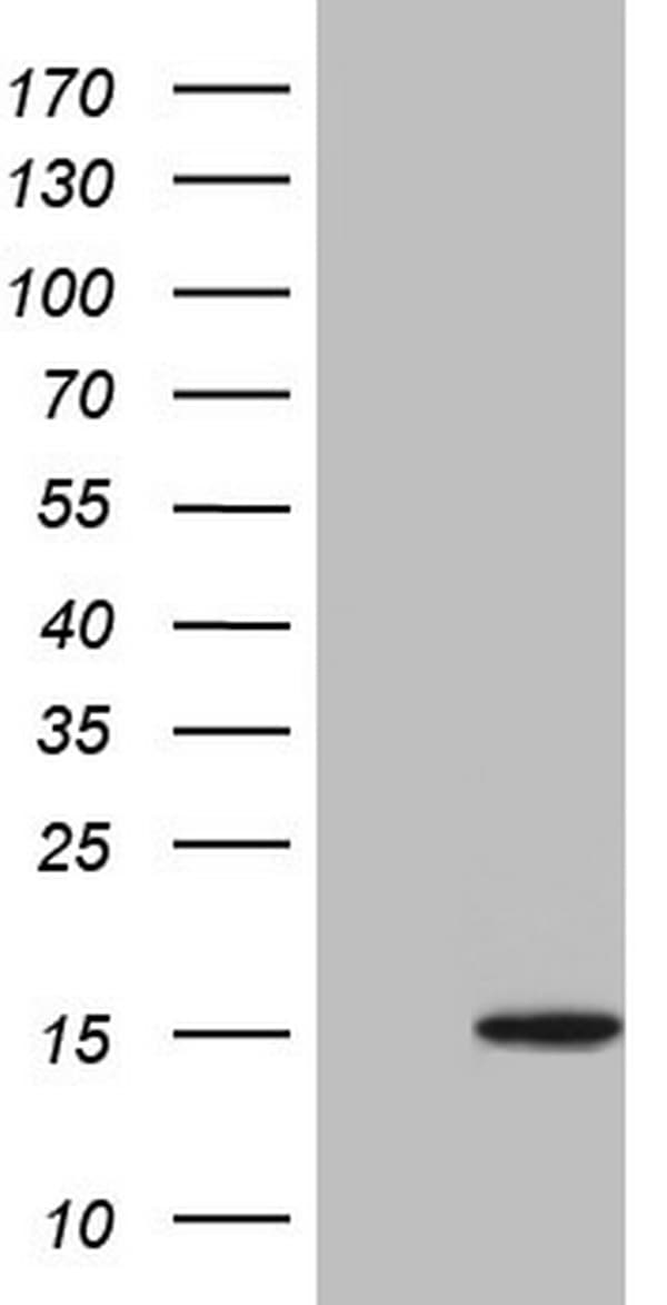 Monoclonal Mouse anti-Human UBA52 Antibody (clone OTI3C1, aa77-128, WB)